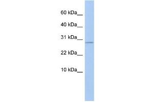 WB Suggested Anti-ANKRD7 Antibody Titration: 0. (ANKRD7 antibody  (Middle Region))