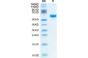 Human 4-1BB/TNFRSF9 on Tris-Bis PAGE under reduced condition. (CD137 Protein (AA 24-186) (Fc-Avi Tag))