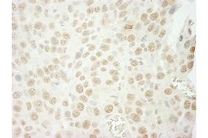 Immunohistochemistry (IHC) image for anti-U2 Small Nuclear RNA Auxiliary Factor 1 (U2AF1) (AA 140-190) antibody (ABIN7448845)