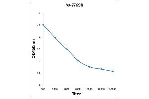 Antigen: 2 µg/100 µL  Primary: Antiserum, 1:500, 1:1000, 1:2000, 1:4000, 1:8000, 1:16000, 1:32000;  Secondary: HRP conjugated Rabbit Anti-Goat IgG at 1: 5000;  TMB staining Read the data in Microplate Reader by 450nm. (Septin 1 antibody  (AA 161-260))