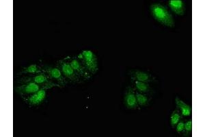 Immunofluorescent analysis of HepG2 cells using ABIN7154072 at dilution of 1:100 and Alexa Fluor 488-congugated AffiniPure Goat Anti-Rabbit IgG(H+L) (Glutathione Peroxidase 2 antibody  (AA 71-168))