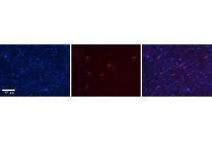 Rabbit Anti-S100A8 Antibody Catalog Number: ARP61367_P050 Formalin Fixed Paraffin Embedded Tissue: Human Heart Tissue Observed Staining: Cytoplasm in endothelial cells in capillaries Primary Antibody Concentration: N/A Other Working Concentrations: 1:600 Secondary Antibody: Donkey anti-Rabbit-Cy3 Secondary Antibody Concentration: 1:200 Magnification: 20X Exposure Time: 0. (S100A8 antibody  (Middle Region))