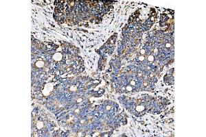 IHC analysis of PMPCA/INPP5 using anti-PMPCA/INPP5 antibody (ABIN7602722). (PMPCA antibody  (AA 99-525))