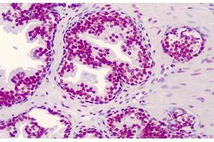 Human Prostate: Formalin-Fixed, Paraffin-Embedded (FFPE) (CBP antibody  (AA 2393-2442))