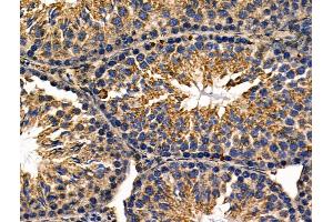 ABIN6257398 and ABIN6276108 at 1/100 staining Mouse testis tissue by IHC-P. (Rho-related GTP-binding protein antibody  (C-Term))