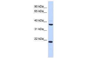 Western Blotting (WB) image for anti-Transmembrane Protein 74 (TMEM74) antibody (ABIN2459633) (TMEM74 antibody)