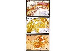 Immunohistochemistry image of BSP staining in paraffn sections of human tissues. (BSP antibody)