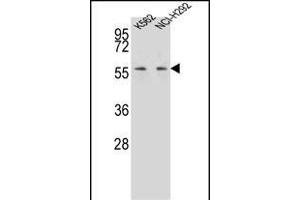 P3 Antibody (C-term) (ABIN656992 and ABIN2846173) western blot analysis in K562,NCI- cell line lysates (35 μg/lane). (MPP3 antibody  (C-Term))
