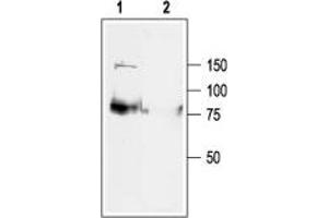 Western blot analysis of rat heart membranes: - 1.