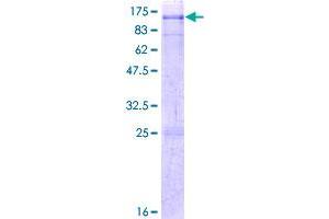 MYST2 Protein (AA 1-611) (GST tag)