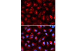 Immunofluorescence (IF) image for anti-Kinesin Light Chain 1 (KLC1) antibody (ABIN1876732) (KLC1 antibody)