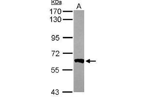 WB Image Sample (50 ug of whole cell lysate) A: Mouse brain 7. (PPP3CB antibody  (Center))