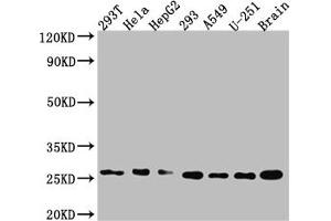 Western Blot Positive WB detected in: 293T whole cell lysate, Hela whole cell lysate, HepG2 whole cell lysate 293 whole cell lysate, A549 whole cell lysate, U-251 whole cell lysate, Mouse Brain whole cell lysate All lanes: Id1 antibody at 1:1000 Secondary Goat polyclonal to rabbit IgG at 1/50000 dilution Predicted band size: 17, 16 kDa Observed band size: 26 kDa (Recombinant ID1 antibody)