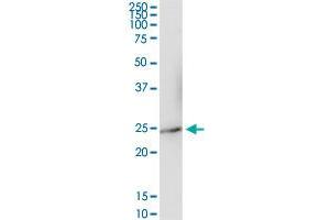 IFNA17 MaxPab rabbit polyclonal antibody. (IFNA17 antibody  (AA 1-189))