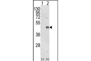 Western blot analysis of CEBPB (arrow) using rabbit polyclonal CEBPB Antibody (C-term) (ABIN652248 and ABIN2841040). (CEBPB antibody  (C-Term))