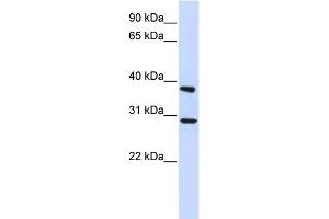 WB Suggested Anti-ING4 Antibody Titration: 0. (ING4 antibody  (Middle Region))