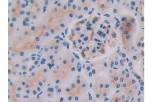 DAB staining on IHC-P; Samples: Rat Kidney Tissue (IL-27 antibody  (AA 32-234))