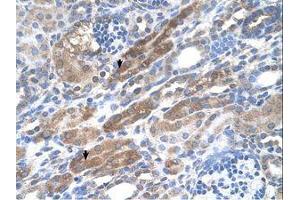 Image no. 1 for anti-KIAA0319 (KIAA0319) (AA 151-200) antibody (ABIN321211) (KIAA0319 antibody  (AA 151-200))