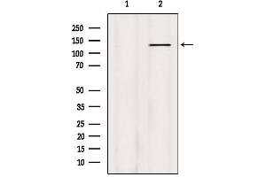 Western blot analysis of extracts from HepG2, using Phospho-Abl (Tyr204) Antibody. (ABL1 antibody  (pTyr204))