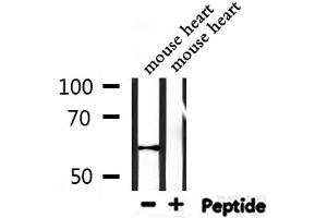 Western blot analysis of extracts from mouse heart, using WEE2 Antibody. (WEE2 antibody)