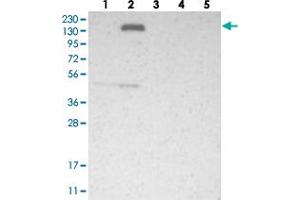 Western blot analysis of Lane 1: RT-4, Lane 2: U-251 MG, Lane 3: Human Plasma, Lane 4: Liver, Lane 5: Tonsil with FNDC3B polyclonal antibody  at 1:250-1:500 dilution. (FNDC3B antibody)