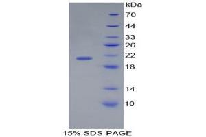 SDS-PAGE (SDS) image for Interleukin 17C (IL17C) (AA 19-197) protein (His tag) (ABIN1879838)