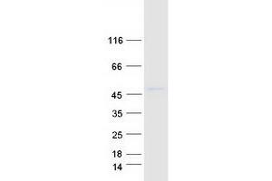 Myb/SANT-Like DNA-Binding Domain Containing 4 with Coiled-Coils (MSANTD4) protein (Myc-DYKDDDDK Tag)