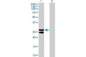 Western Blot analysis of MMAB expression in transfected 293T cell line by MMAB MaxPab polyclonal antibody.