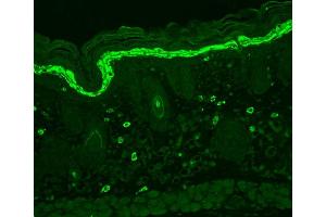 Immunohistochemistry analysis using Mouse Anti-Phosphotyrosine Monoclonal Antibody, Clone G104 . (Phosphotyrosine antibody  (Biotin))