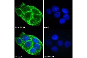 ABIN570874 Immunofluorescence analysis of paraformaldehyde fixed A431 cells, permeabilized with 0.