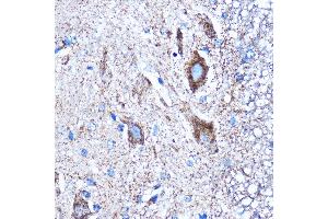 Immunohistochemistry of paraffin-embedded Mouse spinal cord using CTGF Rabbit pAb (ABIN6127717, ABIN6139188, ABIN6139191 and ABIN6215222) at dilution of 1:100 (40x lens). (CTGF antibody  (AA 27-349))