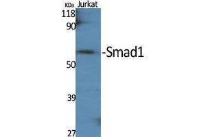 Western Blotting (WB) image for anti-SMAD, Mothers Against DPP Homolog 1 (SMAD1) (Ser789) antibody (ABIN3186981) (SMAD1 antibody  (Ser789))