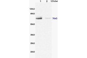L1 rat brain lysates L2 rat heart lysates probed with Anti DENTT Polyclonal Antibody, Unconjugated (ABIN722245) at 1:200 in 4 °C. (TSPY-Like 2 antibody  (AA 251-350))