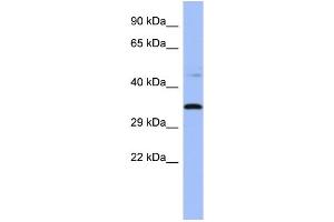 WB Suggested Anti-PYCR1  Antibody Titration: 0. (PYCR1 antibody  (Middle Region))