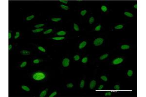 Immunofluorescence of monoclonal antibody to CMAS on HeLa cell. (CMAS antibody  (AA 164-263))