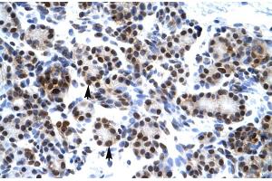 Rabbit Anti-HES7 Antibody Catalog Number: ARP30035 Paraffin Embedded Tissue: Human Pancreas Cellular Data: Epithelial cells of pancreatic acinus Antibody Concentration: 4. (HES7 antibody  (Middle Region))