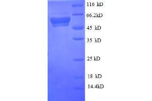 SDS-PAGE (SDS) image for CD14 (CD14) (AA 20-345), (Membrane-Bound) protein (GST tag) (ABIN5709227) (CD14 Protein (CD14) (AA 20-345, Membrane-Bound) (GST tag))