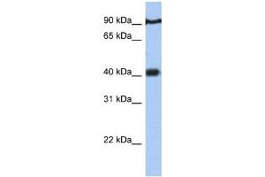 Western Blotting (WB) image for anti-Prostate Tumor Overexpressed 1 (PTOV1) antibody (ABIN2459436) (PTOV1 antibody)