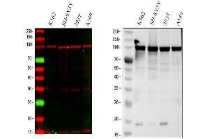 Western blot analysis of MSH2 using anti-MSH2 antibody (ABIN3043885).