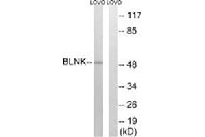 Western blot analysis of extracts from LOVO cells, treated with etoposide 25uM 24h, using BLNK (Ab-96) Antibody.