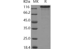 Western Blotting (WB) image for Neurofascin (NFASC) protein (Fc Tag) (ABIN7197149) (NFASC Protein (Fc Tag))