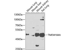 Western blot analysis of extracts of various cell lines, using TMEM184A antibody (ABIN6128873, ABIN6149260, ABIN6149261 and ABIN6223833) at 1:1000 dilution. (TMEM184A antibody  (AA 324-413))