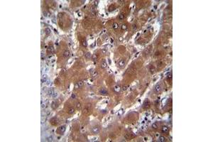 Immunohistochemistry analysis in formalin fixed and paraffin embedded human liver tissue reacted with Cytosolic beta-glucosidase Antibody (C-term) followed by peroxidase conjugation of the secondary antibody and DAB staining. (GBA3 antibody  (C-Term))