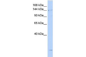 WB Suggested Anti-SMC4 Antibody Titration:  0. (SMC4 antibody  (N-Term))