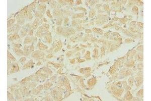 Immunohistochemistry of paraffin-embedded human heart tissue using ABIN7169200 at dilution of 1:100 (TNNI3K antibody  (AA 1-75))