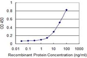 Detection limit for recombinant GST tagged TAGLN is 0. (Transgelin antibody  (AA 1-201))