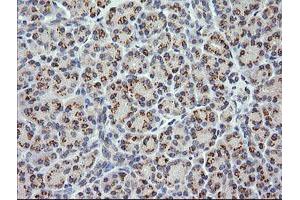 Image no. 1 for anti-Cancer/testis Antigen 1B (CTAG1B) antibody (ABIN1499891) (CTAG1B antibody)