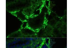 Immunofluorescence analysis of Mouse kidney using COL1A1 Polyclonal Antibody at dilution of 1:100. (COL1A1 antibody)