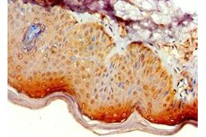 Immunohistochemistry of paraffin-embedded human skin tissue using ABIN7145338 at dilution of 1:100 (ATG14 antibody  (AA 1-310))