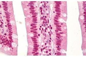 Immunohistochemistry (IHC) image for anti-Tumor Protein P53 (TP53) (acLys379) antibody (ABIN2878849)